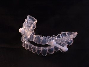 Close-up of an oral appliance for sleep apnea